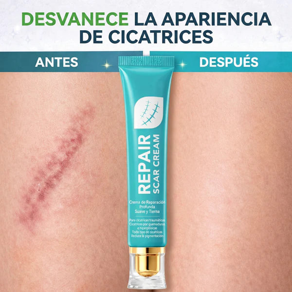 Deje de tapar la cicatrices. Empiece a repararlas — SADOER Repair Cream + Envío Gratis